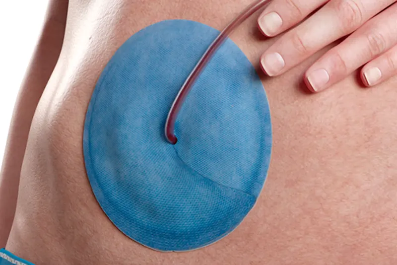 LIQUEEMAX<sup>®</sup> - Kreisdiagramm zur Visualisierung der möglichen Größen